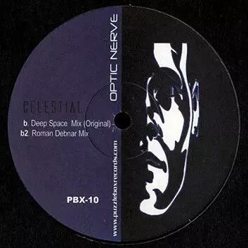 Optic Nerve - Replica Ep